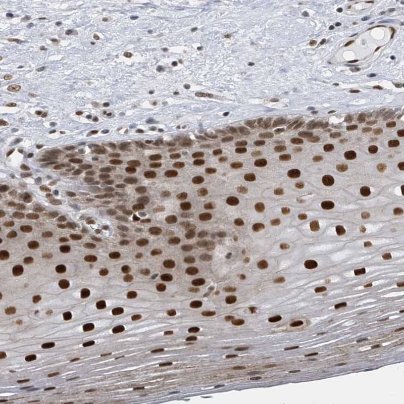 Staining of human esophagus shows strong nuclear positivity in squamous epithelial cells.