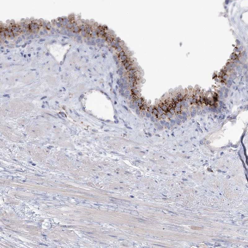 Staining of human prostate shows strong cytoplasmic positivity in glandular cells.