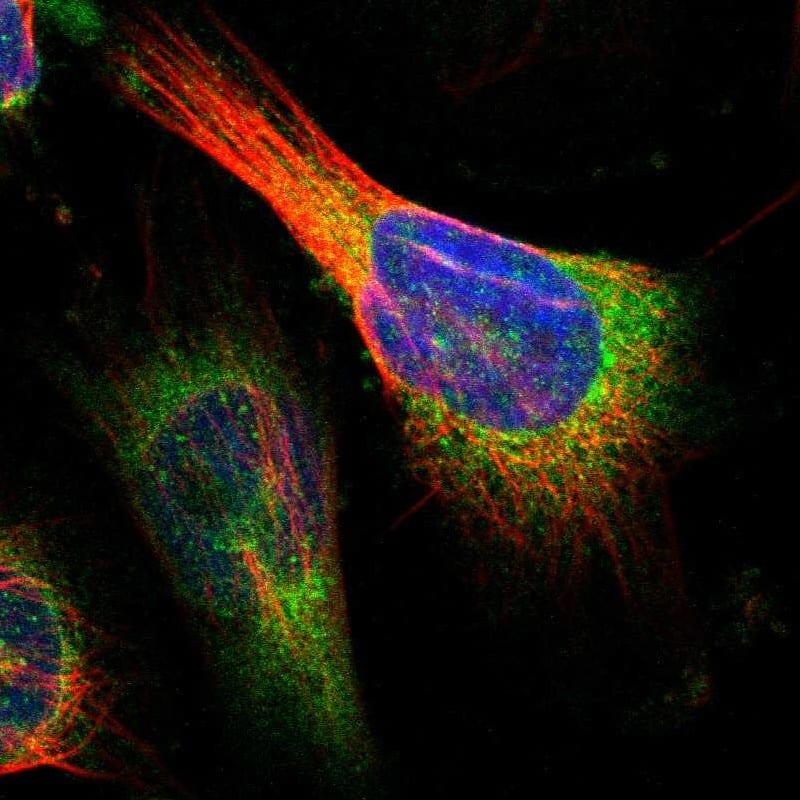 Staining of human cell line U-251 MG shows localization to endoplasmic reticulum.