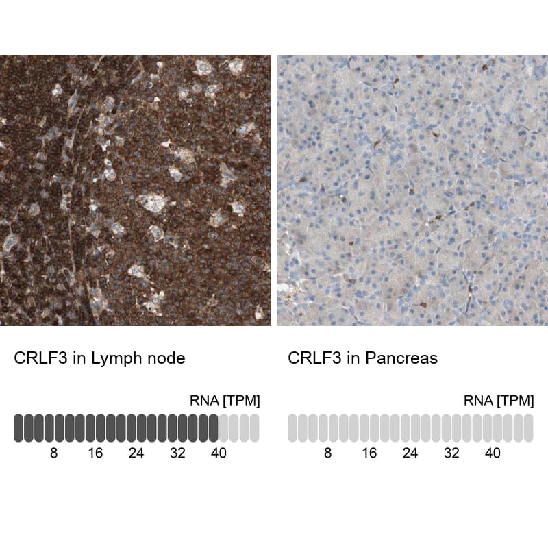 <b>Orthogonal Strategies Validation. </b>Analysis in human lymph node and pancreas tissues using Anti-CRLF3 antibody. Corresponding CRLF3 RNA-seq data are presented for the same tissues.