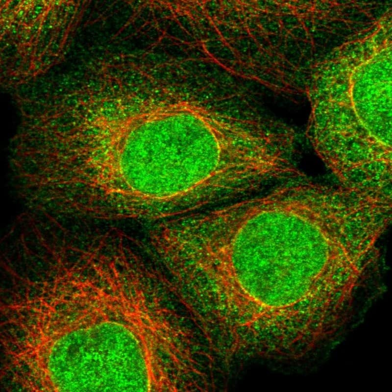 Immunocytochemistry/ Immunofluorescence ZNF213 Antibody - BSA Free