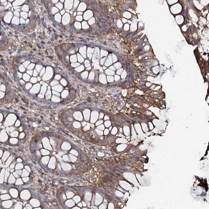 Staining of human colon shows moderate cytoplasmic positivity in glandular cells.
