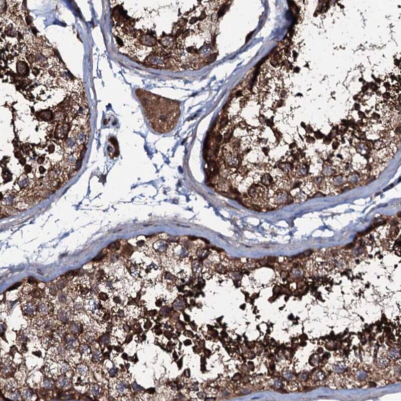 Staining of human testis shows strong cytoplasmic positivity in cells of seminiferous ducts.