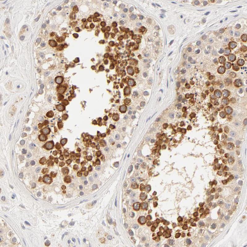 Staining of human testis shows strong membranous and cytoplasmic positivity in cells in seminiferous ducts.