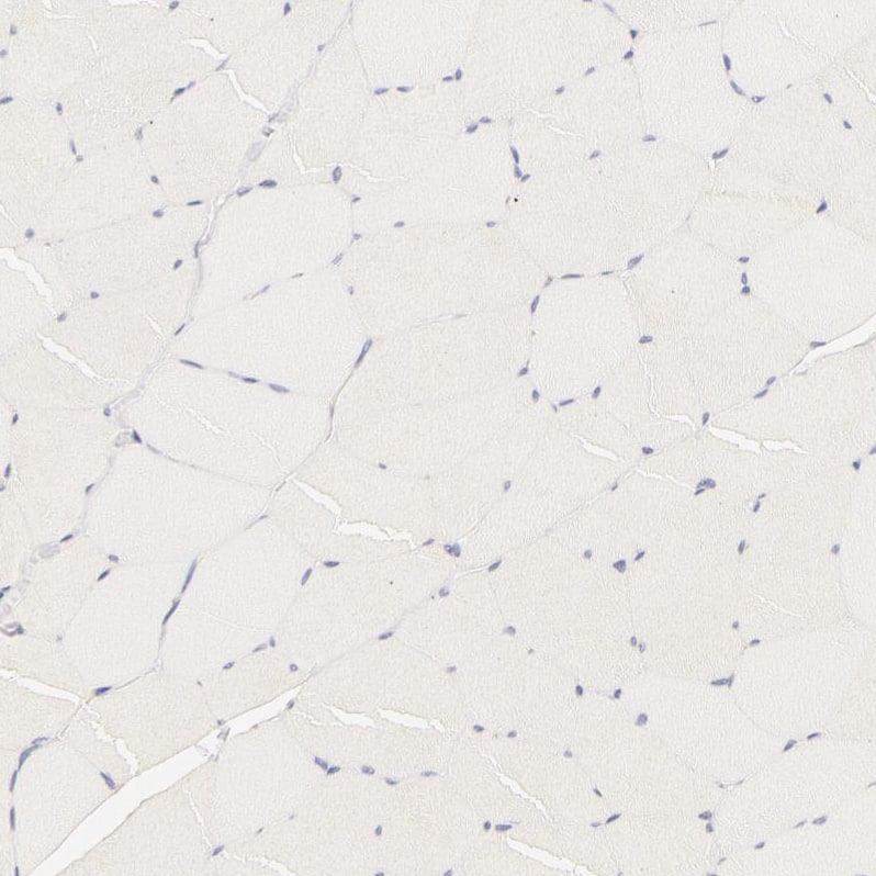 Staining of human skeletal muscle shows no cytoplasmic positivity in myocytes as expected.