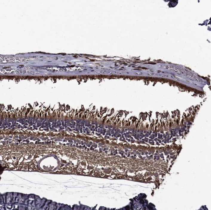Staining of human eye, retina shows strong cytoplasmic positivity.