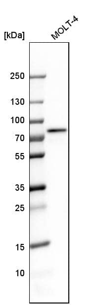Analysis in human cell line MOLT-4.