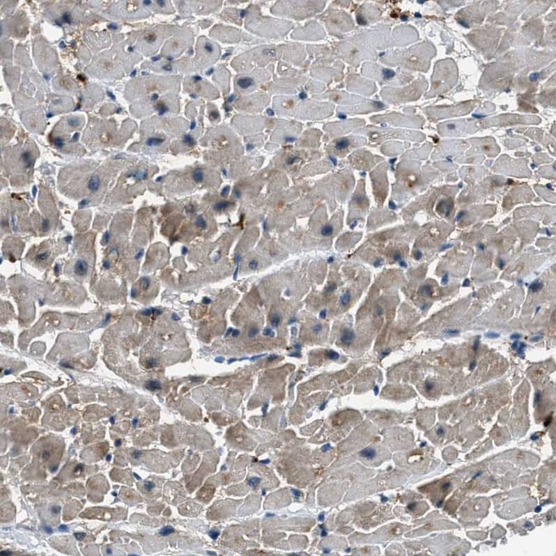 Staining of human Heart muscle shows moderate cytoplasmic positivity in cardiomyocytes.