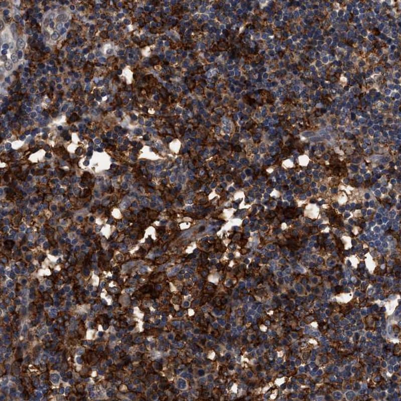 Immunohistochemistry-Paraffin CD300a/LMIR1 Antibody - BSA Free