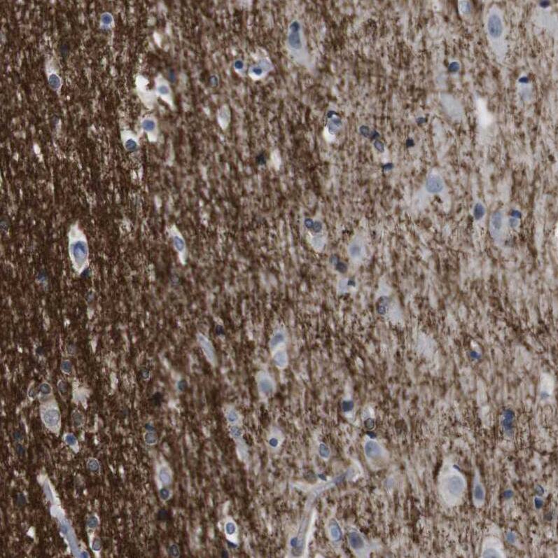 Staining of human cerebral cortex shows strong membranous-cytoplasmic positivity in neuropil.