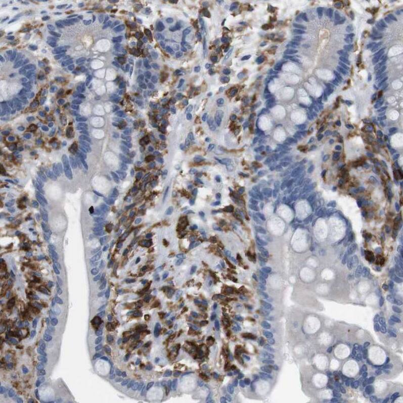 Staining of human colon shows strong membranous-cytoplasmic positivity in lymphoid cells.