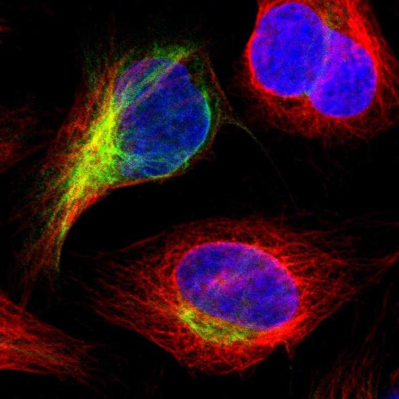 Staining of human cell line U-2 OS shows localization to intermediate filaments.