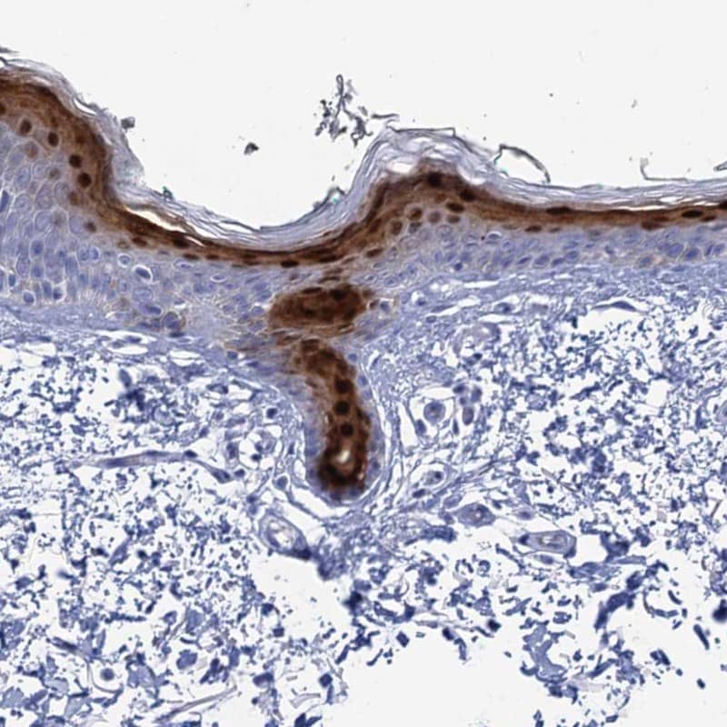 Staining of human skin shows high expression.