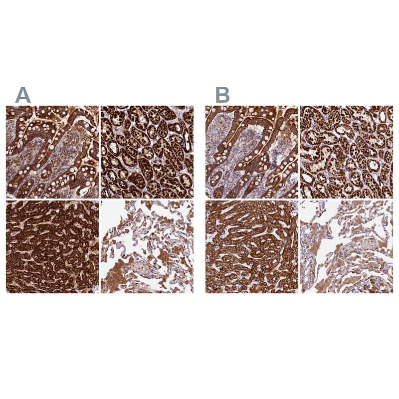 <b>Independent Antibodies Validation. </b>Staining of human gastrointestinal, kidney, liver and lung using Anti-CLYBL antibody HPA039959 (A) shows similar protein distribution across tissues to independent antibody HPA040691 (B).