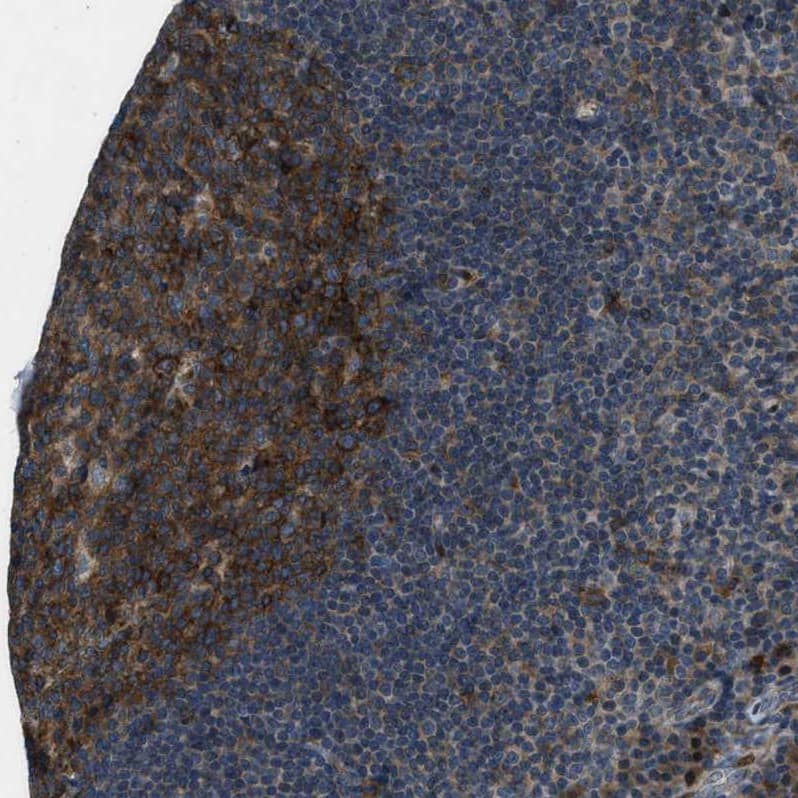Staining of human tonsil shows strong cytoplasmic positivity in germinal center cells.