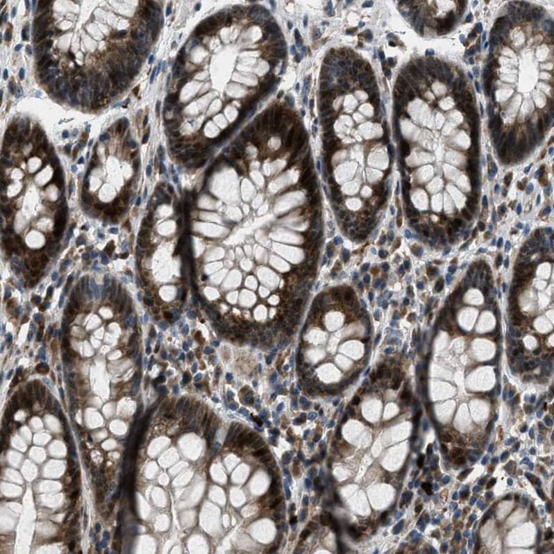 Staining of human rectum shows strong cytoplasmic positivity in glandular cells.