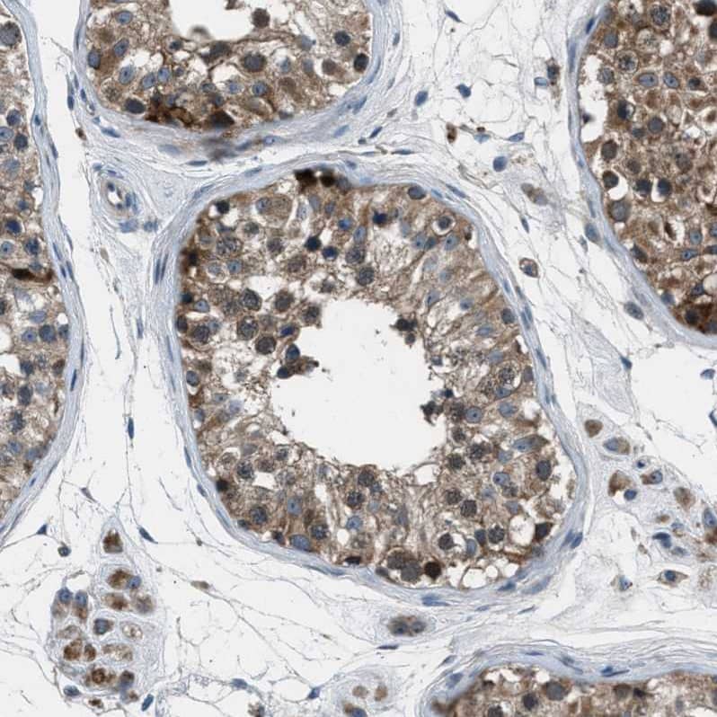 Staining of human testis shows strong cytoplasmic positivity in cells in seminiferous ducts.