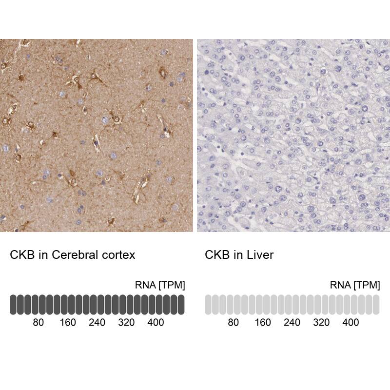 Immunohistochemistry-Paraffin Creatine Kinase BB Antibody - BSA Free