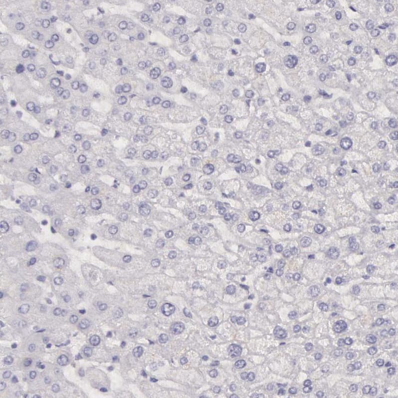 Staining of human liver shows no positivity in hepatocytes as expected.