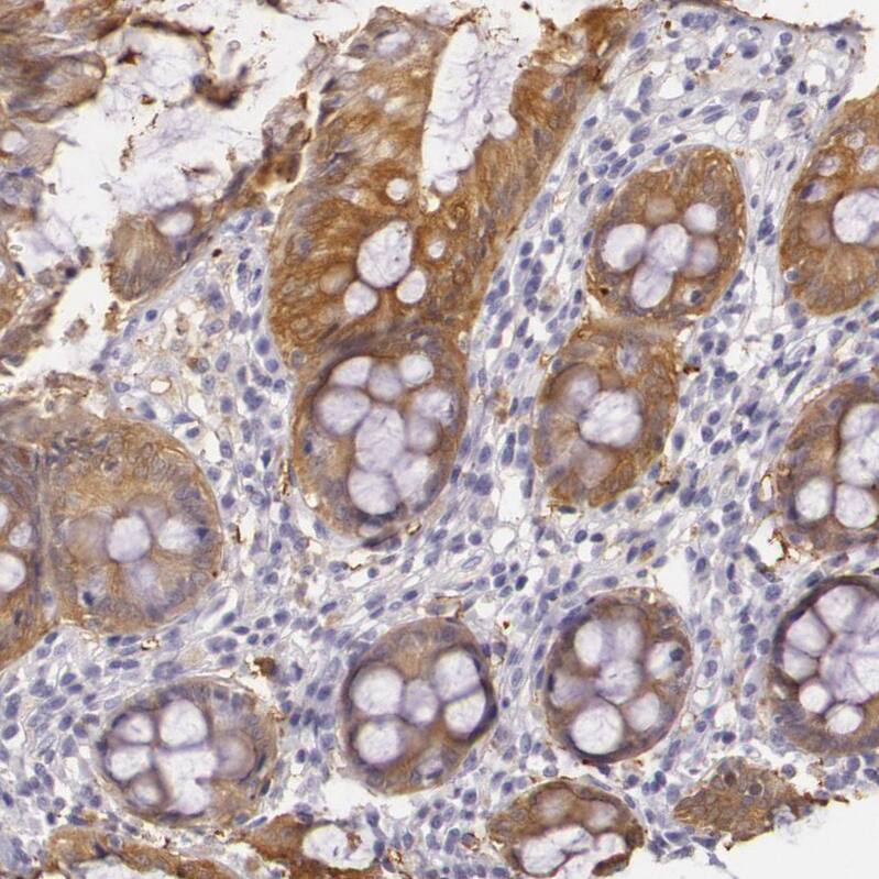 Staining of human rectum shows moderate cytoplasmic positivity in glandular cells.