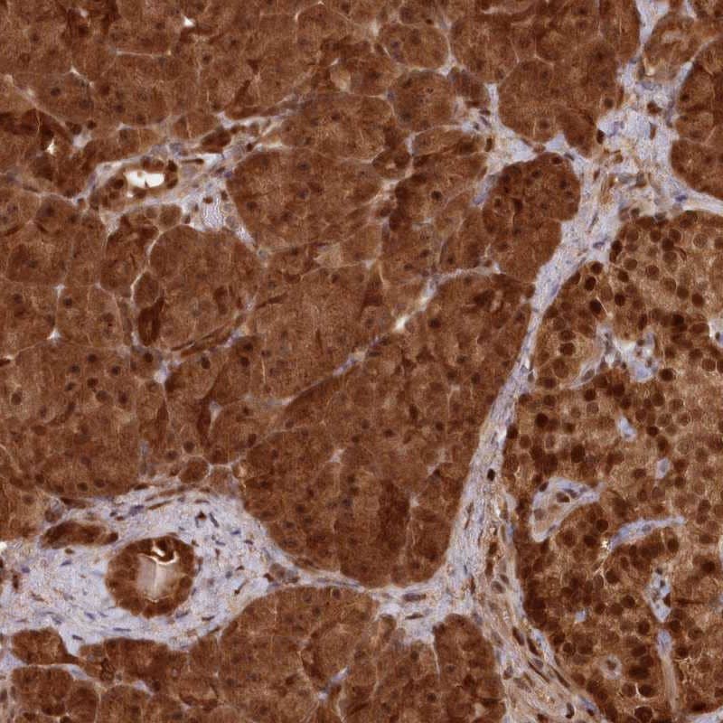 Immunohistochemistry-Paraffin ABHD14B Antibody - BSA Free