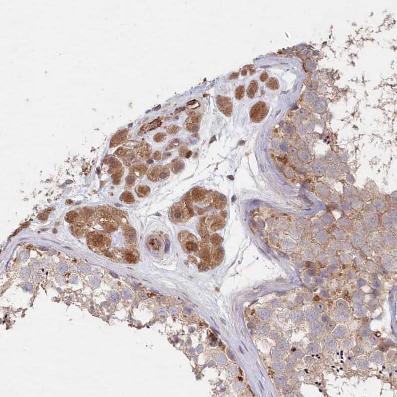 Staining of human testis shows moderate cytoplasmic positivity in Leydig cells.