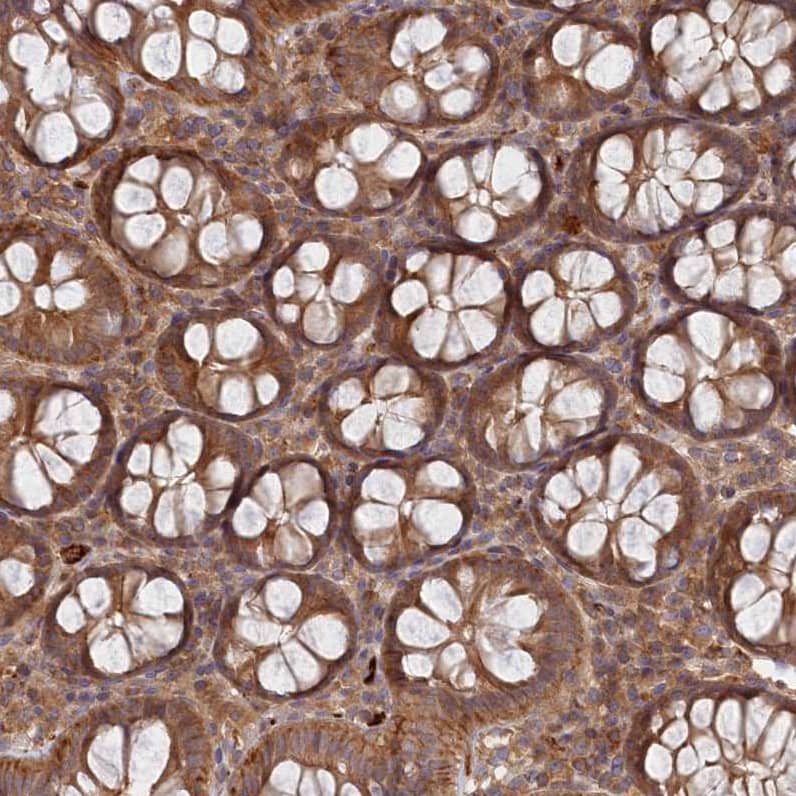 Staining of human colon shows moderate cytoplasmic positivity in glandular cells.