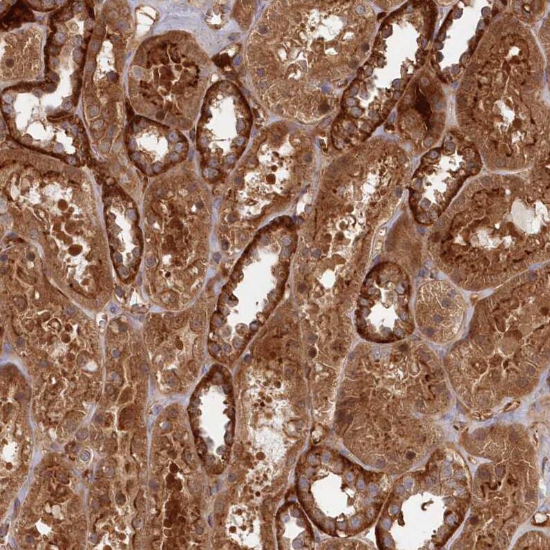 Staining of human kidney shows moderate cytoplasmic positivity in cells in tubules.
