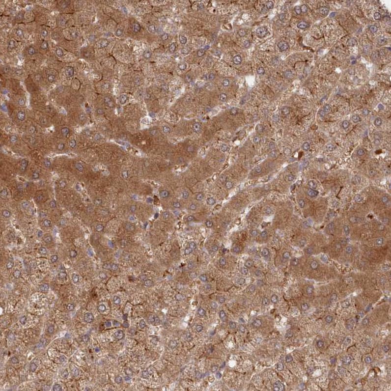 Staining of human liver shows moderate cytoplasmic positivity in hepatocytes.