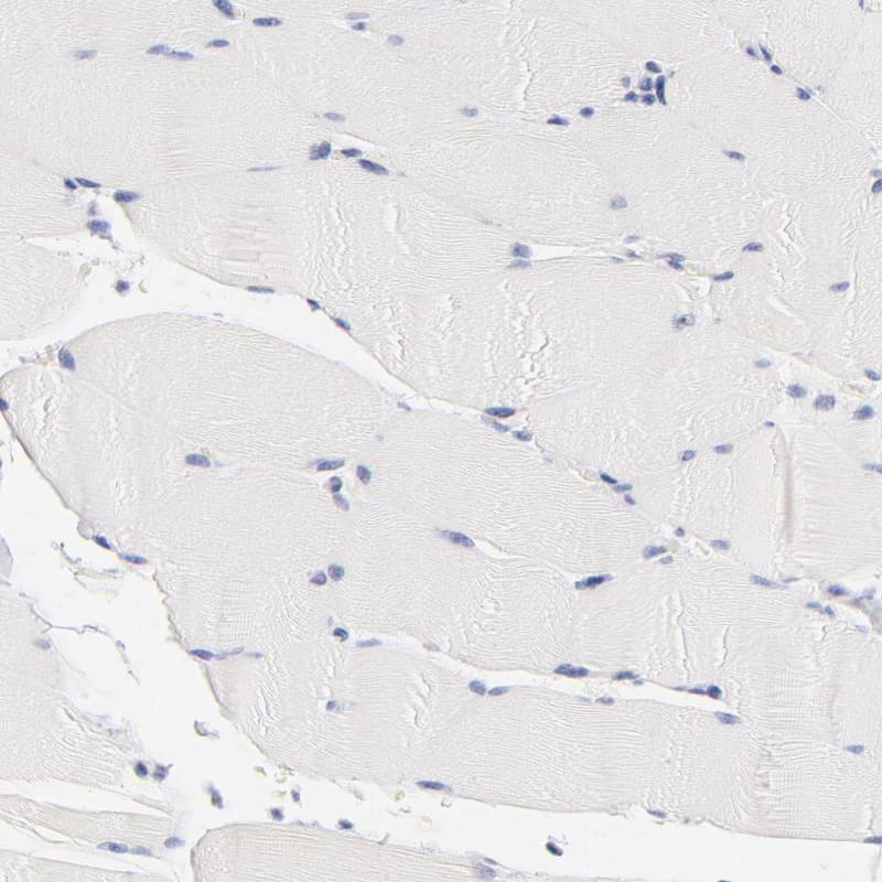 Immunohistochemistry-Paraffin CHX10 Antibody - BSA Free