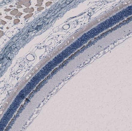 Immunohistochemistry-Paraffin CHX10 Antibody - BSA Free