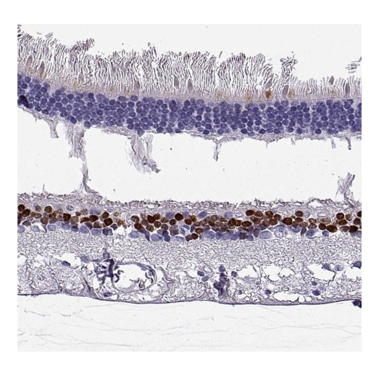 Staining of human retina shows strong nuclear positivity in inner nuclear layer.