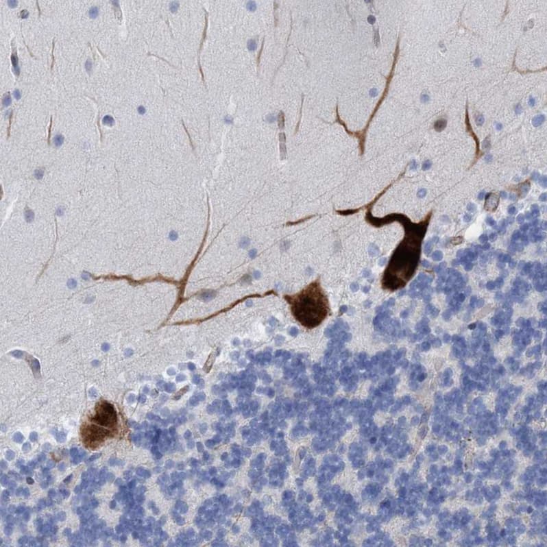 Staining of human cerebellum shows strong granular cytoplasmic positivity in Purkinje cells.