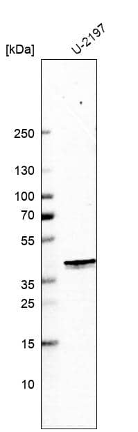 Analysis in human cell line U-2197.