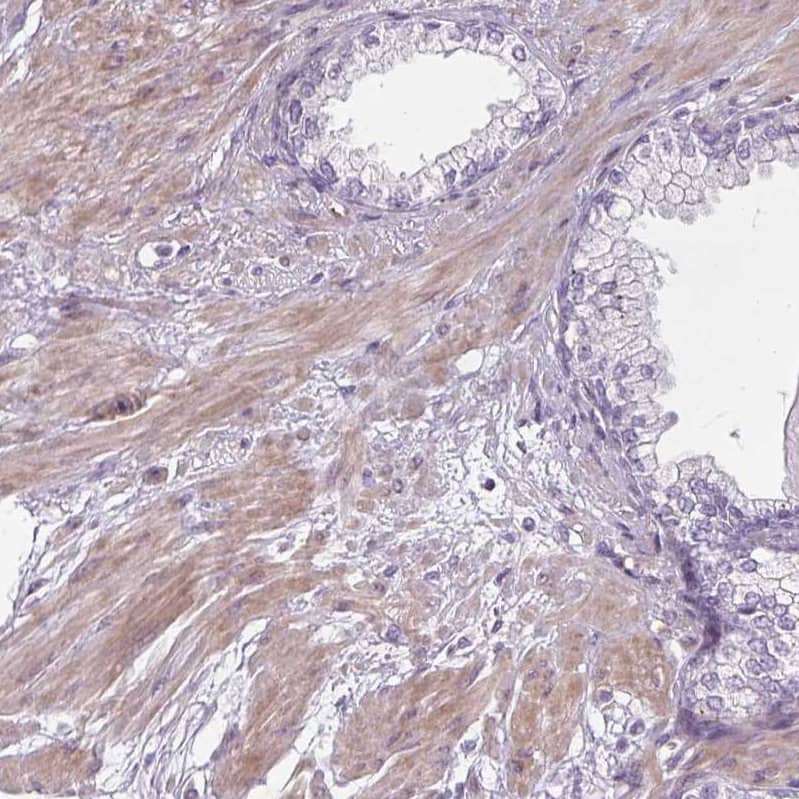 Staining of human prostate shows moderate cytoplasmic positivity in smooth muscle cells.