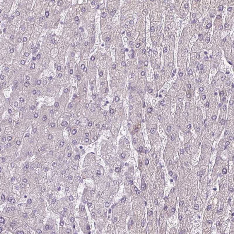 Staining of human liver shows negative cytoplasmic positivity in hepatocytes as expected.