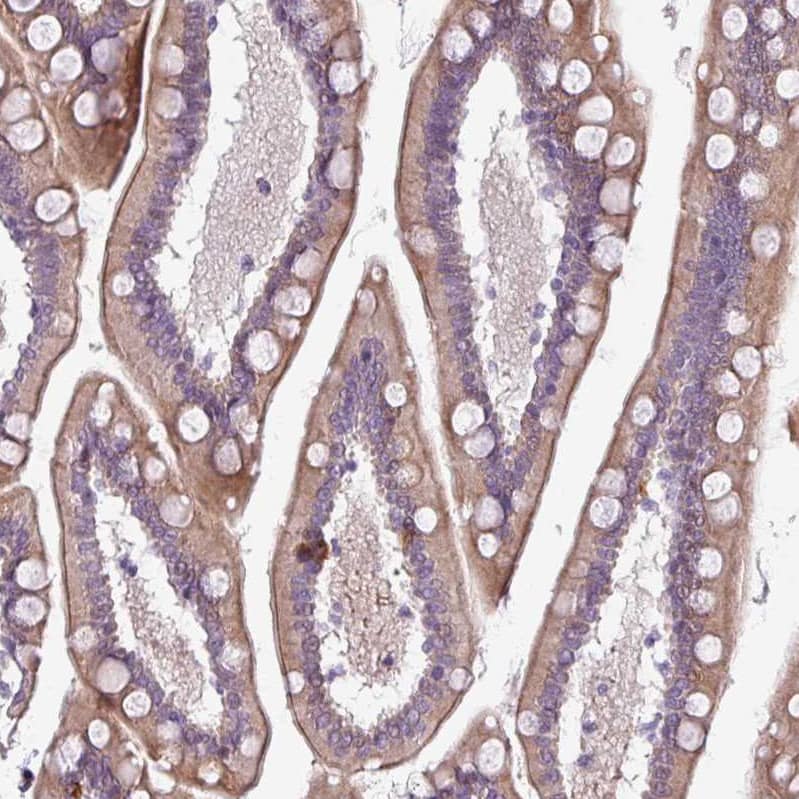 Staining of human small intestine shows moderate cytoplasmic-membranous positivity in glandular cells.