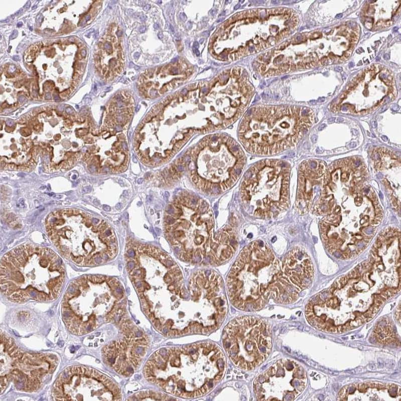 Staining of human kidney shows strong cytoplasmic-membranous positivity in cells in tubules.