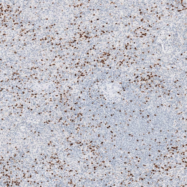 Staining of human spleen shows strong cytoplasmic positivity in cells in red pulp.