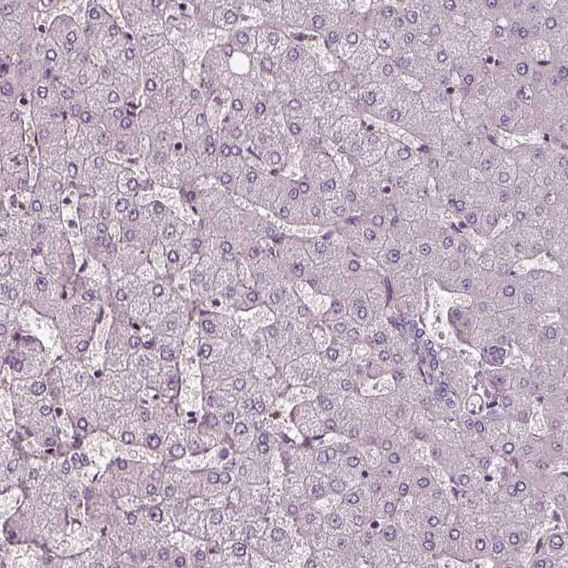 Staining of human liver shows no positivity in hepatocytes as expected.