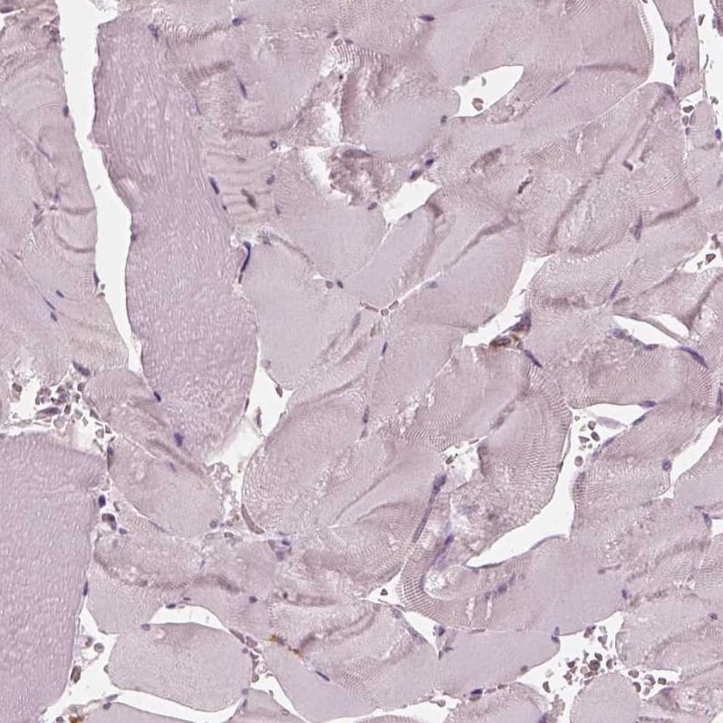 Staining of human skeletal muscle shows no positivity in myocytes as expected.