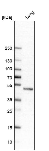 Analysis in human lung tissue.