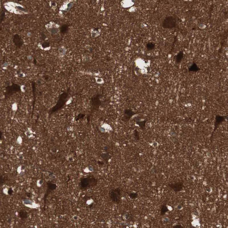 Staining of human cerebral cortex shows strong cytoplasmic positivity in neurons.