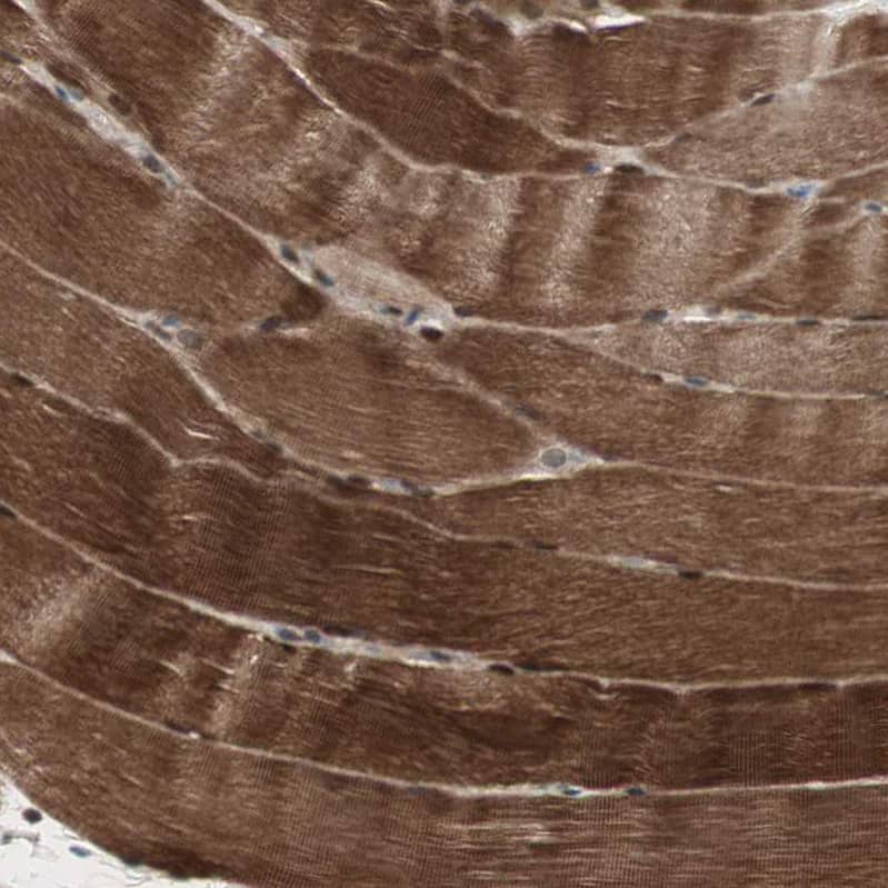 Staining of human skeletal muscle shows moderate to strong cytoplasmic positivity in myocytes.