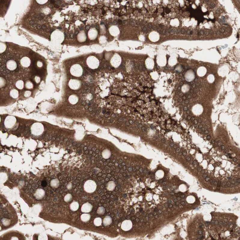 Staining of human small intestine shows strong cytoplasmic positivity in glandular cells.