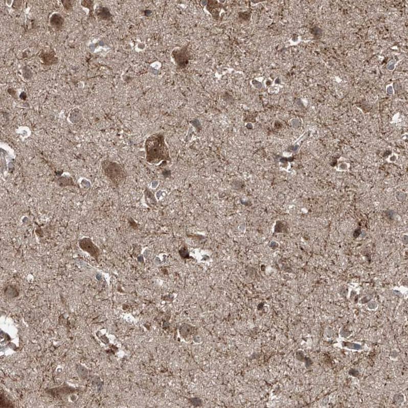 Immunohistochemistry ZDHHC9 Antibody - BSA Free