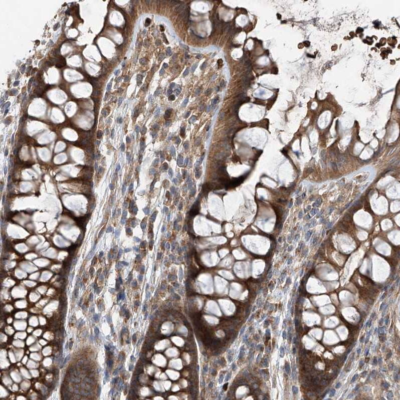 Staining of human colon shows moderate cytoplasmic positivity in glandular cells.