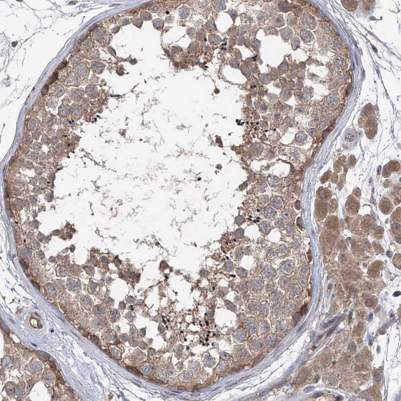 Staining of human testis shows moderate cytoplasmic positivity in cells in seminiferous ducts and Leydig cells.