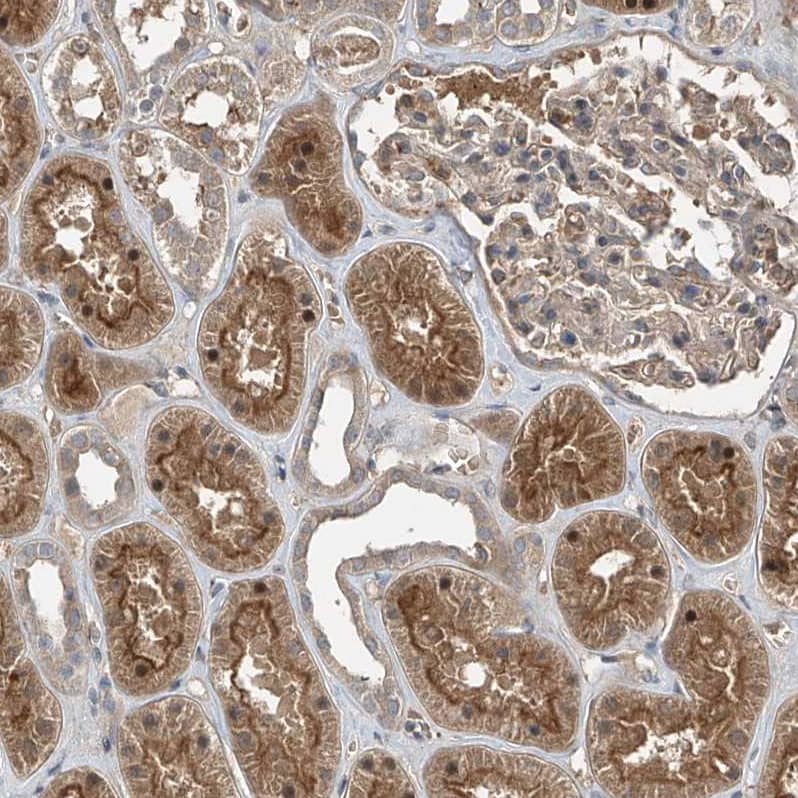 Immunohistochemistry ZDHHC9 Antibody - BSA Free