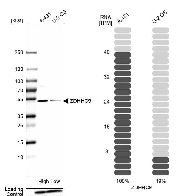 <b>Orthogonal Strategies Validation. </b>Analysis in human cell lines A-431 and U2OS using Anti-ZDHHC9 antibody. Corresponding ZDHHC9 RNA-seq data are presented for the same cell lines. Loading control: Anti-PFN1.